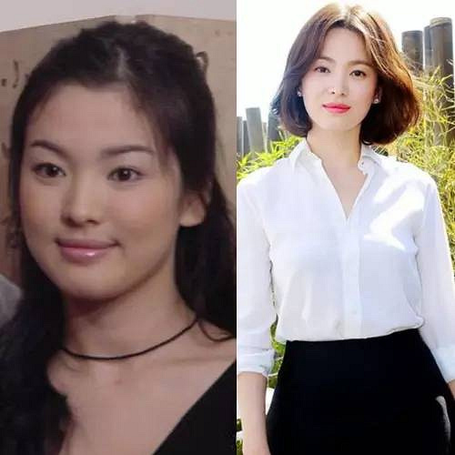 宋慧乔减肥前后比较